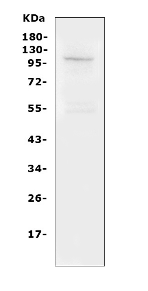 TRPC6 Antibody - Western blot analysis of TRPC6 using anti-TRPC6 antibody. Electrophoresis was performed on a 5-20% SDS-PAGE gel at 70V (Stacking gel) / 90V (Resolving gel) for 2-3 hours. The sample well of each lane was loaded with 50ug of sample under reducing conditions. Lane 1: mouse lung Tissue Lysate After Electrophoresis, proteins were transferred to a Nitrocellulose membrane at 150mA for 50-90 minutes. Blocked the membrane with 5% Non-fat Milk/ TBS for 1.5 hour at RT. The membrane was incubated with rabbit anti-TRPC6 antigen affinity purified polyclonal antibody at 0.5 µg/mL overnight at 4°C, then washed with TBS-0.1% Tween 3 times with 5 minutes each and probed with a goat anti-rabbit IgG-HRP secondary antibody at a dilution of 1:10000 for 1.5 hour at RT. The signal is developed using an Enhanced Chemiluminescent detection (ECL) kit with Tanon 5200 system. A specific band was detected for TRPC6 at approximately 106KD. The expected band size for TRPC6 is at 106KD.