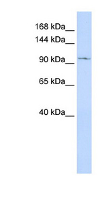 TRPC6 Antibody - TRPC6 antibody Western blot of MCF7 cell lysate. This image was taken for the unconjugated form of this product. Other forms have not been tested.