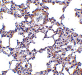 TRPC6 Antibody - Immunohistochemistry of TRPC6 in mouse lung tissue with TRPC6 antibody at 10 ug/ml.