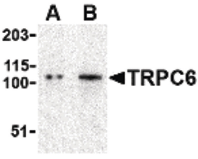 TRPC6 Antibody - Western blot of TRPC6 in K562 cell lysate with TRPC6 antibody at (A) 0.5 and (B) 1 ug/ml.
