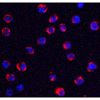 TRPC6 Antibody - Immunofluorescence of TRPC6 in K562 cells with TRPC6 antibody at 5 µg/ml.Red: TRPC6 Antibody  Blue: DAPI staining
