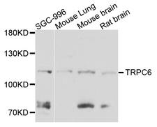 TRPC6 Antibody - Western blot analysis of extract of various cells.