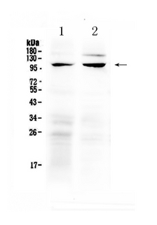 TRPC6 Antibody - Western blot analysis of TRPC6 using anti-TRPC6 antibody. Electrophoresis was performed on a 5-20% SDS-PAGE gel at 70V (Stacking gel) / 90V (Resolving gel) for 2-3 hours. The sample well of each lane was loaded with 50ug of sample under reducing conditions. Lane 1: rat ovary tissue lysate,Lane 2: mouse lung tissue lysate. After Electrophoresis, proteins were transferred to a Nitrocellulose membrane at 150mA for 50-90 minutes. Blocked the membrane with 5% Non-fat Milk/ TBS for 1.5 hour at RT. The membrane was incubated with rabbit anti-TRPC6 antigen affinity purified polyclonal antibody at 0.5 µg/mL overnight at 4°C, then washed with TBS-0.1% Tween 3 times with 5 minutes each and probed with a goat anti-rabbit IgG-HRP secondary antibody at a dilution of 1:10000 for 1.5 hour at RT. The signal is developed using an Enhanced Chemiluminescent detection (ECL) kit with Tanon 5200 system. A specific band was detected for TRPC6 at approximately 106KD. The expected band size for TRPC6 is at 106KD.