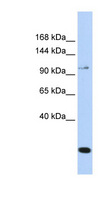 TRPC6 Antibody - TRPC6 antibody Western blot of MCF7 cell lysate. This image was taken for the unconjugated form of this product. Other forms have not been tested.