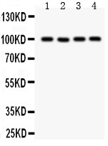 TRPC7 Antibody - TRP 7 antibody Western blot. All lanes: Anti TRP 7 at 0.5 ug/ml. Lane 1: Mouse Brain Tissue Lysate at 50 ug. Lane 2: A549 Whole Cell Lysate at 40 ug. Lane 3: COLO320 Whole Cell Lysate at 40 ug. Lane 4: SKOV Whole Cell Lysate at 40 ug. Predicted band size: 99 kD. Observed band size: 99 kD.