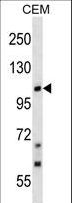 TRPC7 Antibody - TRPC7 Antibody western blot of CEM cell line lysates (35 ug/lane). The TRPC7 antibody detected the TRPC7 protein (arrow).