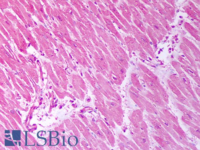 TRPC7 Antibody - Anti-TRPC7 antibody IHC of human heart. Immunohistochemistry of formalin-fixed, paraffin-embedded tissue after heat-induced antigen retrieval. Antibody concentration 10 ug/ml.  This image was taken for the unconjugated form of this product. Other forms have not been tested.