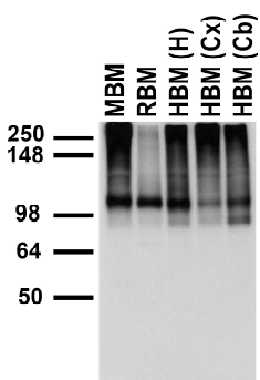 TRPC7 Antibody - Membranes from mouse (MBM) and rat (RBM) brain, human hippocampus [HBM(H)], cerebral cortex [HBM(Cx)] and cerebellum [HBM(Cb)].