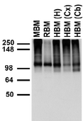 TRPC7 Antibody - Membranes from mouse (MBM) and rat (RBM) brain, human hippocampus [HBM(H)], cerebral cortex [HBM(Cx)] and cerebellum [HBM(Cb)].