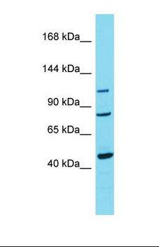TRPC7 Antibody - Western blot of Human Breast Tumor. TRPC7 antibody dilution 1.0 ug/ml.  This image was taken for the unconjugated form of this product. Other forms have not been tested.