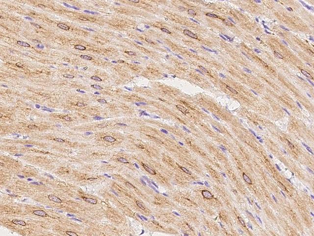 TRPC7 Antibody - Immunochemical staining of human TRPC7 in cynomolgus heart with rabbit polyclonal antibody at 1:300 dilution, formalin-fixed paraffin embedded sections.