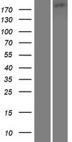 TRPM1 Protein - Western validation with an anti-DDK antibody * L: Control HEK293 lysate R: Over-expression lysate