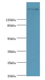 TRPM2 Antibody - Western blot. All lanes: TRPM2 antibody at 2 ug/ml+k562 whole cell lysate. Secondary antibody: Goat polyclonal to rabbit at 1:10000 dilution. Predicted band size: 171 kDa. Observed band size: 171 kDa.