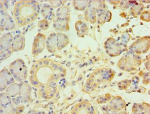 TRPM2 Antibody - Immunohistochemistry of paraffin-embedded human pancreas tissue using antibody 1:100 dilution.