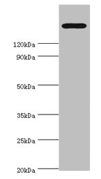 TRPM2 Antibody - Western blot All lanes: TRPM2 antibody at 2µg/ml + K562 whole cell lysate Secondary Goat polyclonal to rabbit IgG at 1/10000 dilution Predicted band size: 172, 166, 96 kDa Observed band size: 172 kDa
