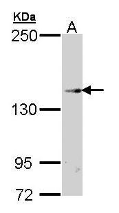 TRPM2 Antibody - Sample (30 ug of whole cell lysate). A: Hep G2 . 7.5% SDS PAGE. TRPM2 antibody diluted at 1:500.