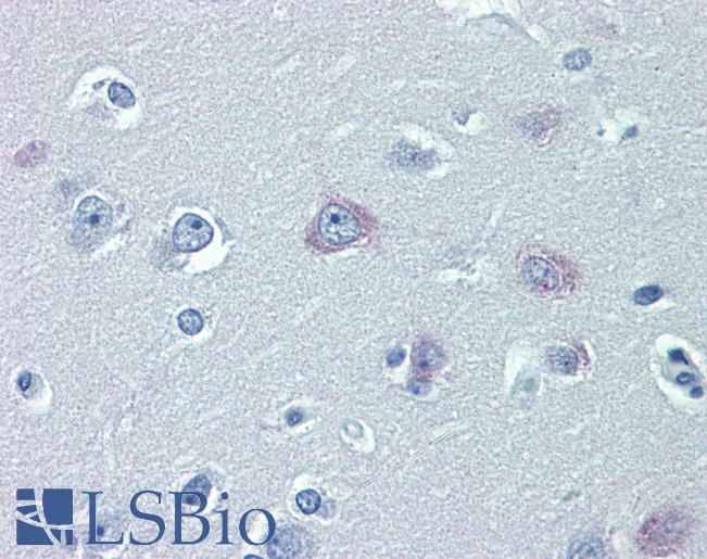 TRPM2 Antibody - Anti-TRPM2 antibody IHC of human brain, cortex. Immunohistochemistry of formalin-fixed, paraffin-embedded tissue after heat-induced antigen retrieval. Antibody concentration 10 ug/ml.  This image was taken for the unconjugated form of this product. Other forms have not been tested.