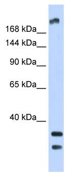 TRPM2 Antibody - Western blot of Fetal Brain Lysate.  This image was taken for the unconjugated form of this product. Other forms have not been tested.