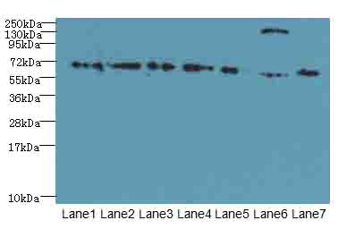 TRPM2 Antibody - Western blot. All lanes: TRPM2 antibody at 3 ug/ml. Lane 1: HepG-2 whole cell lysate. Lane 2: Mouse brain tissue. Lane 3: A549 whole cell lysate. Lane 4: K562 whole cell lysate. Lane 5: Mouse kidney tissue. Lane 6: Human placenta tissue. Lane 7: Mouse spleen tissue. Secondary Goat polyclonal to Rabbit IgG at 1:10000 dilution. Predicted band size: 171 kDa. Observed band size: 70,180 kDa.