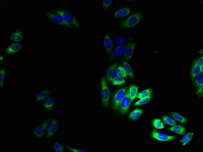 TRPM2 Antibody - Immunofluorescent analysis of HepG2 cells using TRPM2 Antibody at dilution of 1:100 and Alexa Fluor 488-congugated AffiniPure Goat Anti-Rabbit IgG(H+L)