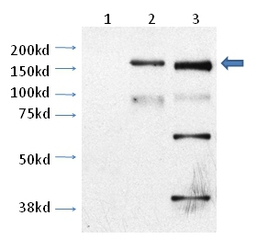 TRPM2 Antibody - TRPM2 antibody - Detection of TRPM2. Lane 1: CHO cells untransfected. Lane 2: CHO cell transfected with rat TRPM2 Lane 3: Mouse cortical neurons (cultured).  This image was taken for the unconjugated form of this product. Other forms have not been tested.