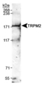 TRPM2 Antibody - Detection of TRPM2 in mouse brain membrane lysates.  This image was taken for the unconjugated form of this product. Other forms have not been tested.