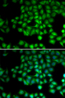 TRPM2 Antibody - Immunofluorescence analysis of HeLa cells.