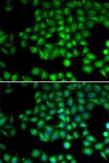 TRPM2 Antibody - Immunofluorescence analysis of HeLa cells.