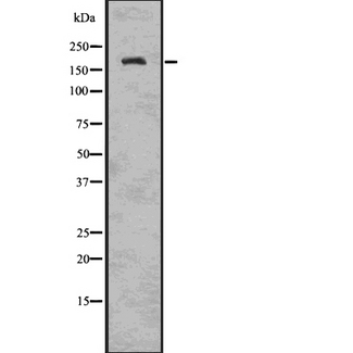 TRPM2 Antibody - Western blot analysis of TRPM2 using K562 whole cells lysates