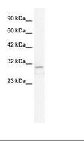 TRPM3 Antibody - Jurkat Cell Lysate.  This image was taken for the unconjugated form of this product. Other forms have not been tested.