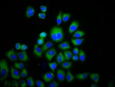 TRPM3 Antibody - Immunofluorescence staining of Hela cells diluted at 1:133, counter-stained with DAPI. The cells were fixed in 4% formaldehyde, permeabilized using 0.2% Triton X-100 and blocked in 10% normal Goat Serum. The cells were then incubated with the antibody overnight at 4°C.The Secondary antibody was Alexa Fluor 488-congugated AffiniPure Goat Anti-Rabbit IgG (H+L).