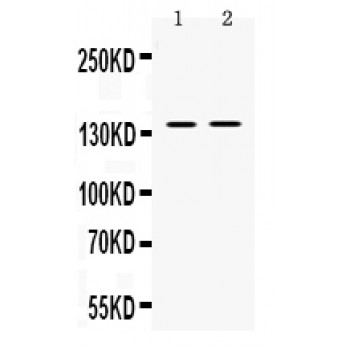 TRPM4 Antibody - Western blot analysis of TRPM4 expression in mouse spleen extract (lane 1) and SW620 whole cell lysates (lane 2). TRPM4 at 134 kD was detected using rabbit anti- TRPM4 Antigen Affinity purified polyclonal antibody at 0.5 ug/mL. The blot was developed using chemiluminescence (ECL) method.