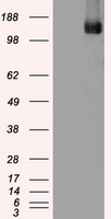 TRPM4 Antibody - HEK293T cells were transfected with the pCMV6-ENTRY control (Left lane) or pCMV6-ENTRY TRPM4 (Right lane) cDNA for 48 hrs and lysed. Equivalent amounts of cell lysates (5 ug per lane) were separated by SDS-PAGE and immunoblotted with anti-TRPM4.