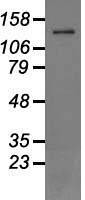 TRPM4 Antibody - Western blot analysis of 35ug of cell extracts from human brain tissue lysates using anti-TRPM4 antibody.