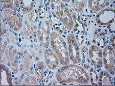 TRPM4 Antibody - Immunohistochemical staining of paraffin-embedded Kidney tissue using anti-TRPM4 mouse monoclonal antibody. (Dilution 1:50).