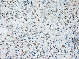 TRPM4 Antibody - Immunohistochemical staining of paraffin-embedded Ovary tissue using anti-TRPM4 mouse monoclonal antibody. (Dilution 1:50).