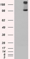 TRPM4 Antibody - HEK293T cells were transfected with the pCMV6-ENTRY control (Left lane) or pCMV6-ENTRY TRPM4 (Right lane) cDNA for 48 hrs and lysed. Equivalent amounts of cell lysates (5 ug per lane) were separated by SDS-PAGE and immunoblotted with anti-TRPM4.