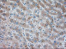 TRPM4 Antibody - IHC of paraffin-embedded liver tissue using anti-TRPM4 mouse monoclonal antibody. (Dilution 1:50).