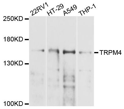 TRPM4 Antibody - Western blot analysis of extracts of various cell lines, using TRPM4 antibody at 1:1000 dilution. The secondary antibody used was an HRP Goat Anti-Rabbit IgG (H+L) at 1:10000 dilution. Lysates were loaded 25ug per lane and 3% nonfat dry milk in TBST was used for blocking. An ECL Kit was used for detection and the exposure time was 45s.