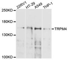 TRPM4 Antibody - Western blot analysis of extracts of various cell lines, using TRPM4 antibody at 1:1000 dilution. The secondary antibody used was an HRP Goat Anti-Rabbit IgG (H+L) at 1:10000 dilution. Lysates were loaded 25ug per lane and 3% nonfat dry milk in TBST was used for blocking. An ECL Kit was used for detection and the exposure time was 45s.