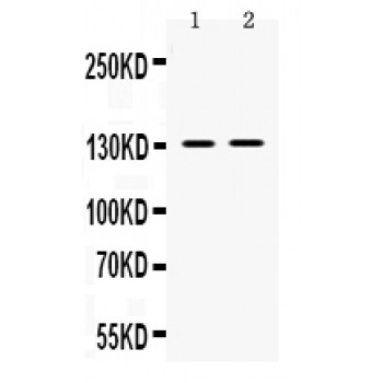 TRPM5 Antibody - Western blot analysis of TRPM5 expression in SMMC whole cell lysates (lane 1) and 293T whole cell lysates (lane 2). TRPM5 at 131 kD was detected using rabbit anti- TRPM5 Antigen Affinity purified polyclonal antibody at 0.5 ug/mL. The blot was developed using chemiluminescence (ECL) method.