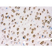 TRPM5 Antibody - TRPM5 was detected in paraffin-embedded sections of mouse brain tissues using rabbit anti- TRPM5 Antigen Affinity purified polyclonal antibody at 1 ug/mL. The immunohistochemical section was developed using SABC method.