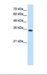 TRPM5 Antibody - HepG2 cell lysate. Antibody concentration: 1.25 ug/ml. Gel concentration: 12%.  This image was taken for the unconjugated form of this product. Other forms have not been tested.