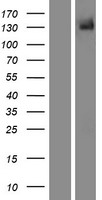 TRPM5 Protein - Western validation with an anti-DDK antibody * L: Control HEK293 lysate R: Over-expression lysate
