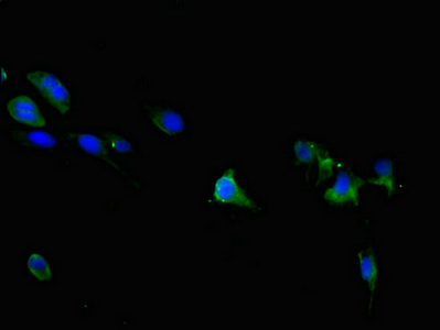 TRPM6 Antibody - Immunofluorescent analysis of 293 cells diluted at 1:100 and Alexa Fluor 488-congugated AffiniPure Goat Anti-Rabbit IgG(H+L)