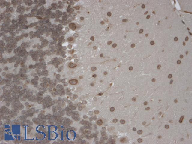 TRPM7 Antibody - IHC analysis of TrpM7 tested on mouse brain using a dilution of TRPM7 antibody. Strong positivity of the nuclear membrane of every cell.  This image was taken for the unconjugated form of this product. Other forms have not been tested.