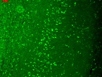 TRPM7 Antibody - TrpM7 (S74-25), Human hippocampus.  This image was taken for the unconjugated form of this product. Other forms have not been tested.