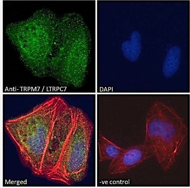 TRPM7 Antibody - Goat Anti-TRPM7 / LTRPC7 Antibody Immunofluorescence analysis of paraformaldehyde fixed U2OS cells, permeabilized with 0.15% Triton. Primary incubation 1hr (10ug/ml) followed by Alexa Fluor 488 secondary antibody (2ug/ml), showing nuclear and cytoplasmic staining. Actin filaments were stained with phalloidin (red) and the nuclear stain is DAPI (blue). Negative control: Unimmunized goat IgG (10ug/ml) followed by Alexa Fluor 488 secondary antibody (2ug/ml).