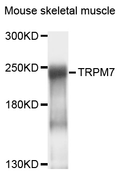 TRPM7 Antibody - Western blot analysis of extracts of mouse skeletal muscle, using TRPM7 antibody at 1:1000 dilution. The secondary antibody used was an HRP Goat Anti-Rabbit IgG (H+L) at 1:10000 dilution. Lysates were loaded 25ug per lane and 3% nonfat dry milk in TBST was used for blocking. An ECL Kit was used for detection and the exposure time was 10s.