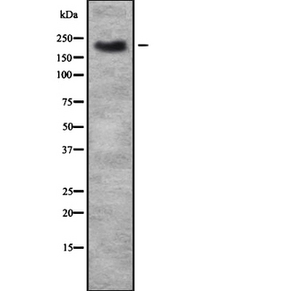 TRPM7 Antibody - Western blot analysis of TRMP7 using HepG2 whole cells lysates